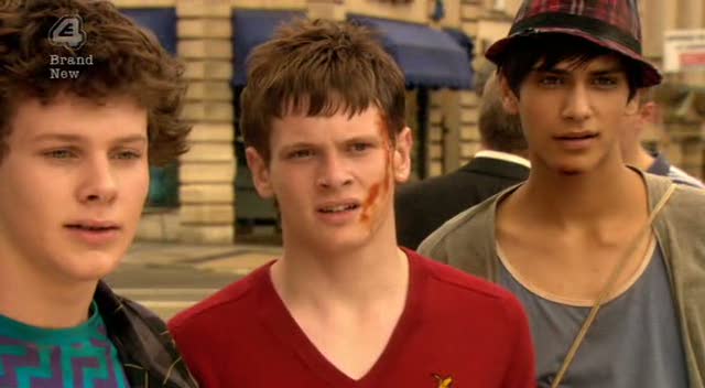 Skins