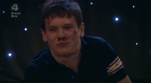 Skins